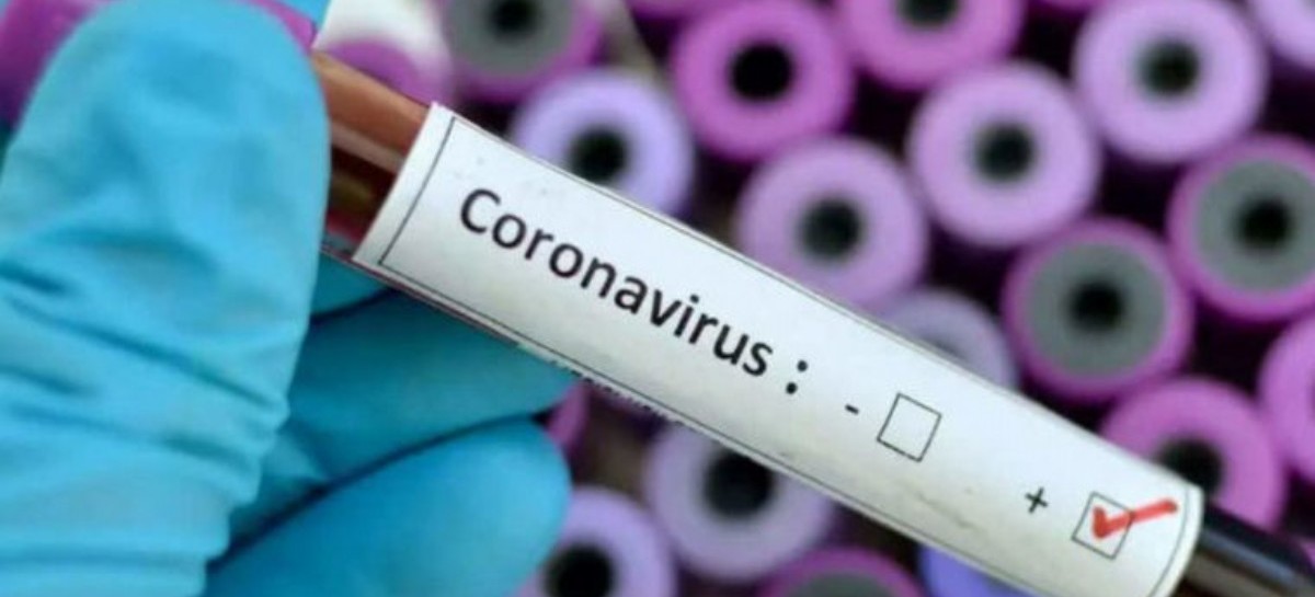 Coronavirus: el Gobierno nacional confirmó 127 muertes y 7.147 nuevos contagios en las últimas 24 hs