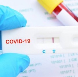 REPORTE DIARIO VESPERTINO Nro 240 - SITUACIÓN DE COVID-19 EN ARGENTINA:  2.657 nuevos casos