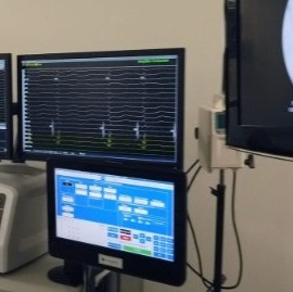 Hospital San Martín de La Plata, pionero en una técnica para curar arritmias cardíacas