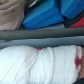 Tres menores robaron en una farmacia céntrica de La Plata y uno de ellos terminó herido e internado