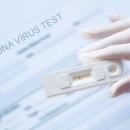 Ante el aumento de contagios e hisopados, la ANMAT autorizó el uso de cuatro autotest de Coronavirus