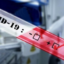 REPORTE DIARIO VESPERTINO Nro 244- SITUACIÓN DE COVID-19 EN ARGENTINA:  3.645 nuevos casos