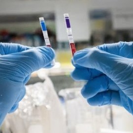 07-12-2020 // Coronavirus: el Gobierno nacional confirmó 118 muertes y 3.119 nuevos contagios